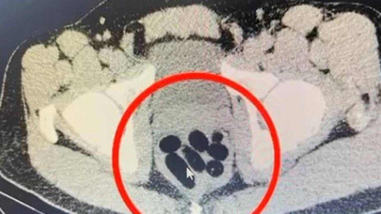 kayseride uyusturucu operasyonu midesinden cikan soke etti d2r81JQF.jpg